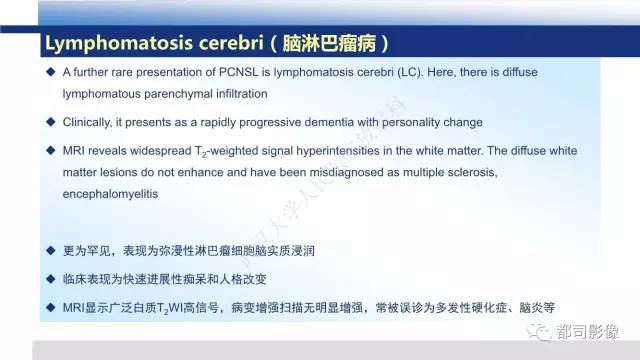 【PPT】原发性中枢神经系统淋巴瘤影像诊断