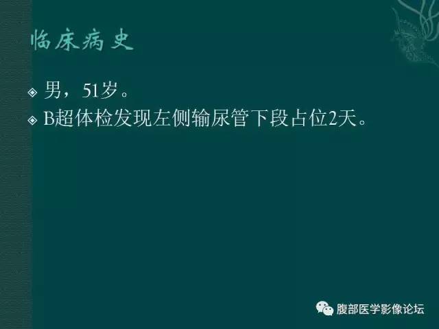【病例】左输尿管下段区副神经节瘤1例CT影像表现
