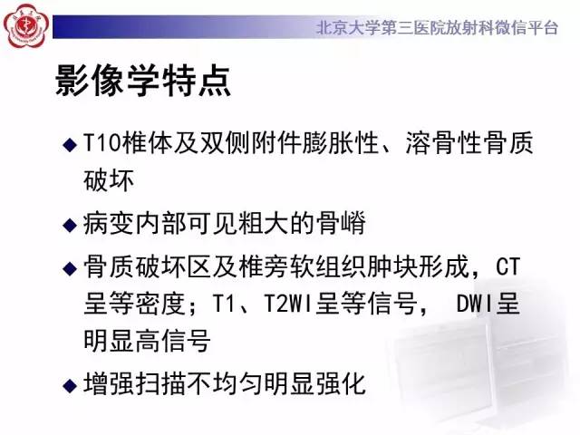 【病例】脊柱孤立性浆细胞瘤1例CT/MR影像表现