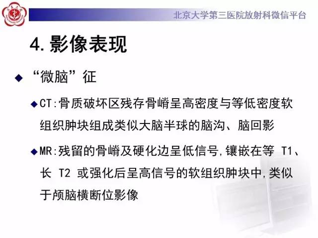 【病例】脊柱孤立性浆细胞瘤1例CT/MR影像表现