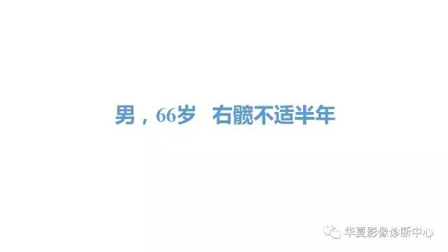 【病例】髋关节淋巴瘤1例X线CT及MR影像表现