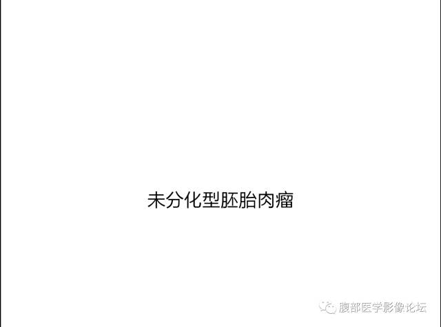 【病例】肝未分化胚胎型肉瘤1例CT 【病例】肝未分化胚胎型肉瘤1例CT
