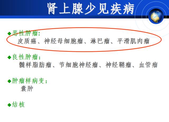 【PPT】肾上腺少见疾病的影像诊断