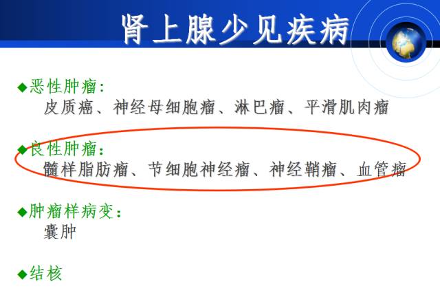 【PPT】肾上腺少见疾病的影像诊断