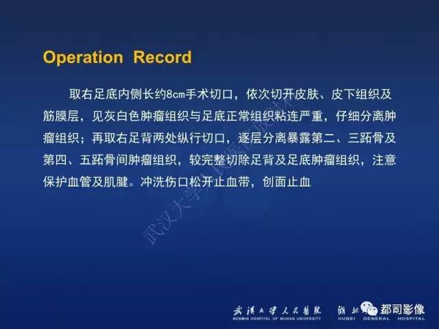 【PPT】肌骨纤维瘤病的影像学表现