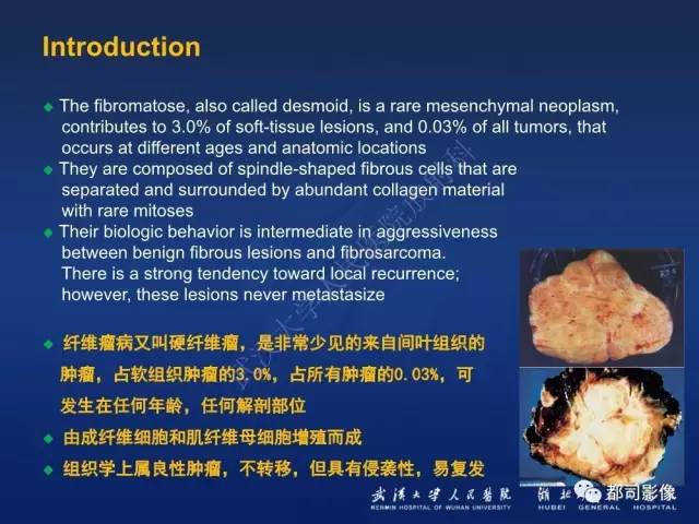 【PPT】肌骨纤维瘤病的影像学表现