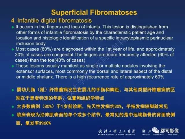 【PPT】肌骨纤维瘤病的影像学表现