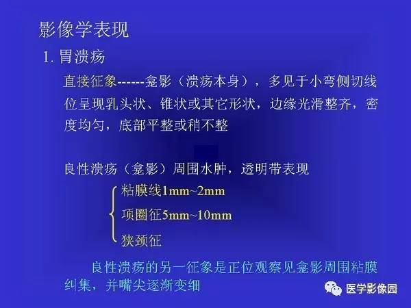 【PPT】胃十二指肠溃疡与胃癌的影像学表现