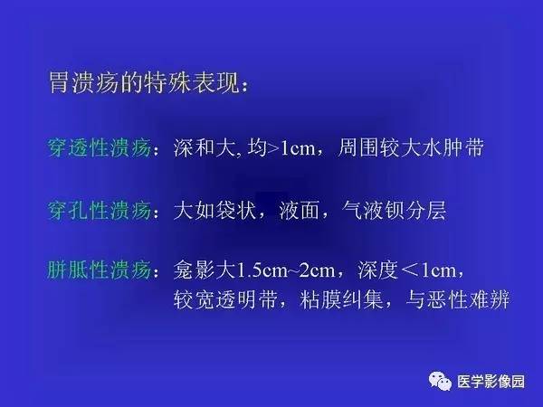 【PPT】胃十二指肠溃疡与胃癌的影像学表现