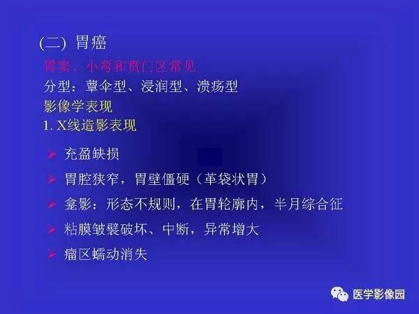 【PPT】胃十二指肠溃疡与胃癌的影像学表现