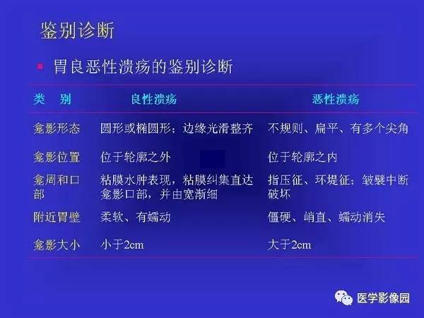 【PPT】胃十二指肠溃疡与胃癌的影像学表现