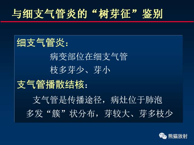 【PPT】肺结核的基础CT表现