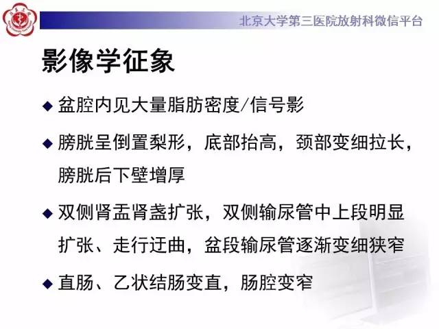 【病例】盆腔脂肪增多症1例CT及MR