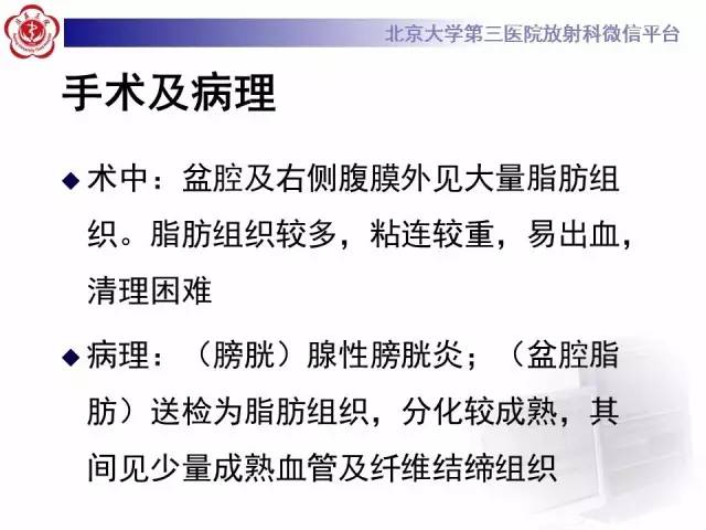 【病例】盆腔脂肪增多症1例CT及MR
