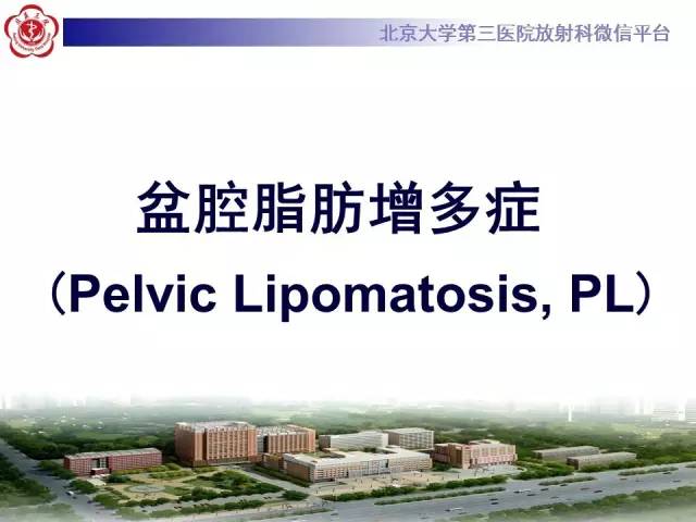 【病例】盆腔脂肪增多症1例CT及MR