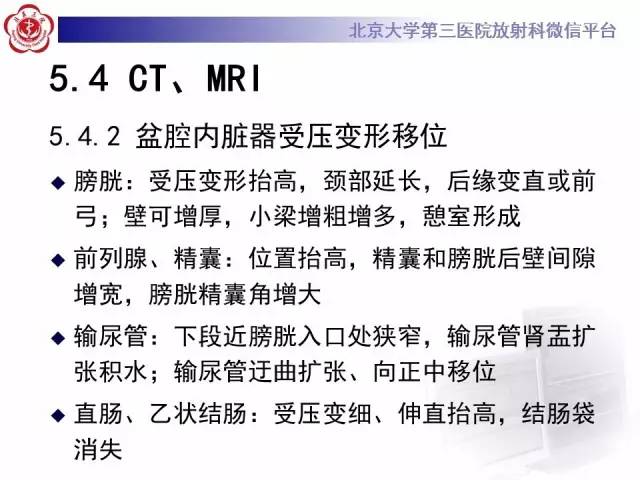 【病例】盆腔脂肪增多症1例CT及MR