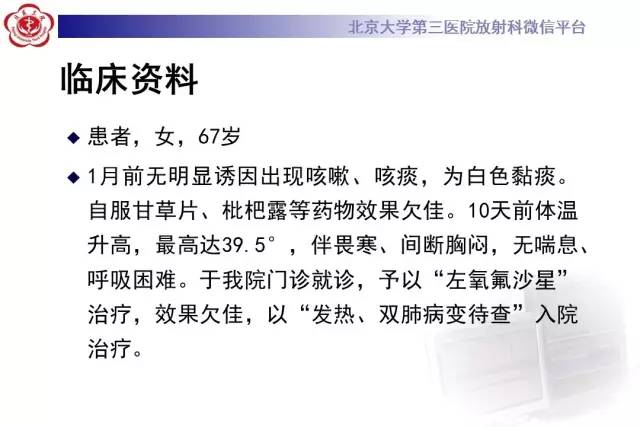【病例】过敏性肺炎1例CT影像诊断与鉴别