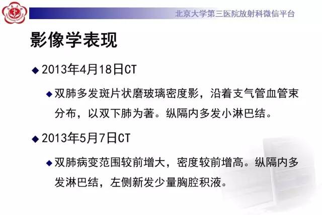 【病例】过敏性肺炎1例CT影像诊断与鉴别