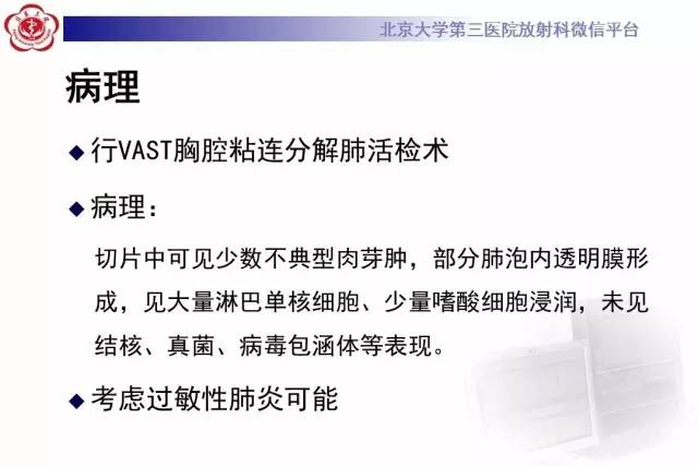 【病例】过敏性肺炎1例CT影像诊断与鉴别