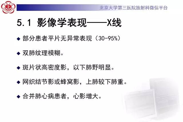 【病例】过敏性肺炎1例CT影像诊断与鉴别