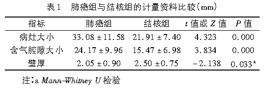 薄壁囊腔型肺癌与薄壁空洞性肺结核的MDCT表现鉴别诊断研究 薄壁囊腔型肺癌与薄壁空洞性肺结核的MDCT表现鉴别诊断研究