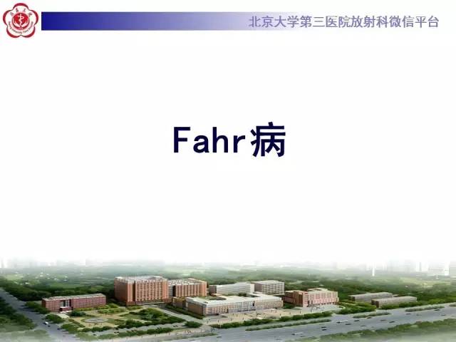 【病例】Fahr病1例CT影像表现与鉴别