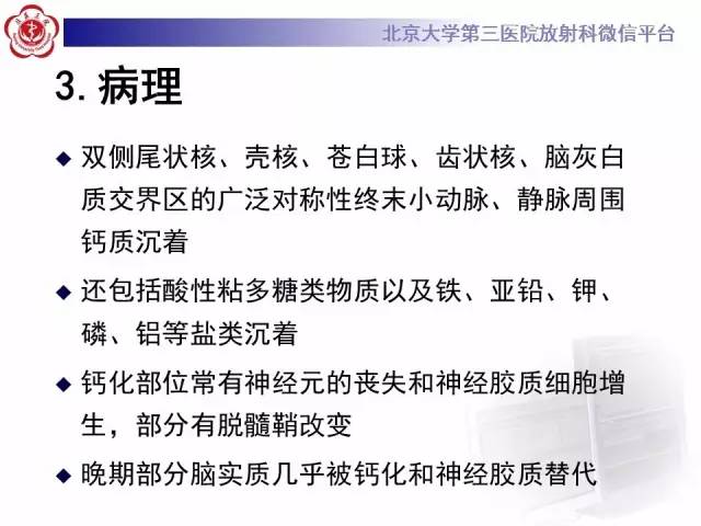 【病例】Fahr病1例CT影像表现与鉴别