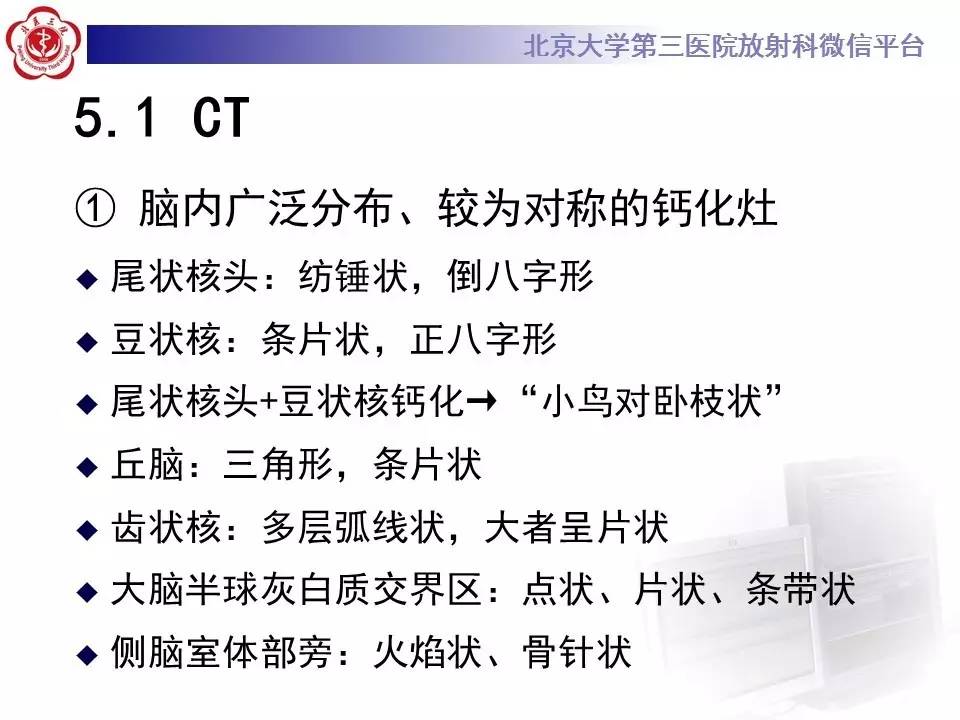 【病例】Fahr病1例CT影像表现与鉴别