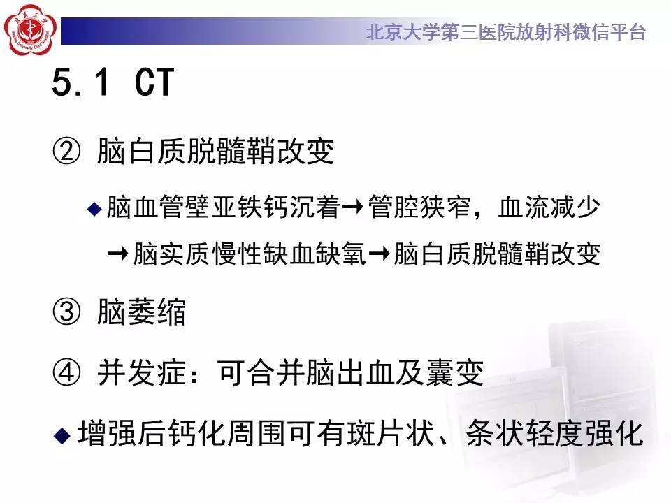 【病例】Fahr病1例CT影像表现与鉴别