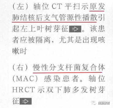 【书摘】“树芽征”的鉴别诊断