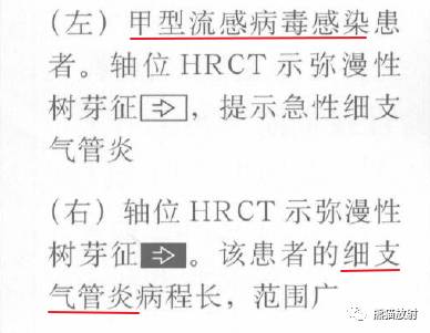 【书摘】“树芽征”的鉴别诊断