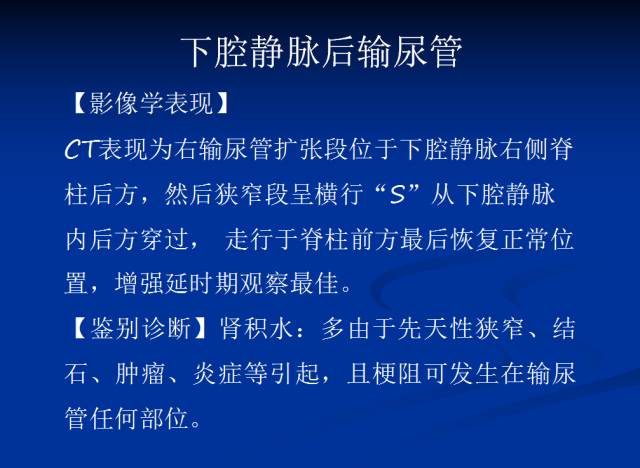 【PPT】泌尿系先天性发育异常的CT诊断