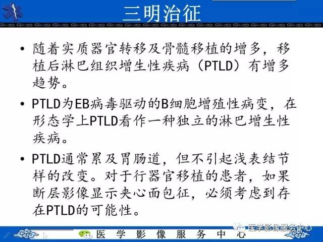 【影像征象】三明治征