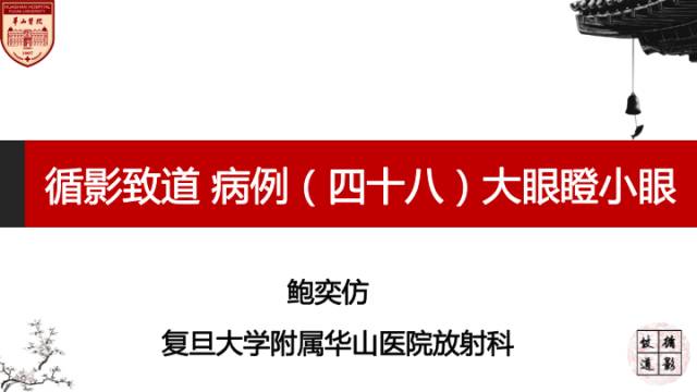 【病例】HIV弓形体脑病1例MR影像表现