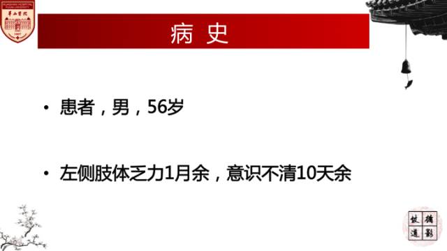 【病例】HIV弓形体脑病1例MR影像表现
