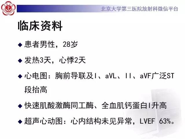 【病例】急性心肌炎1例CMR表现