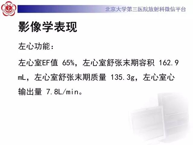 【病例】急性心肌炎1例CMR表现