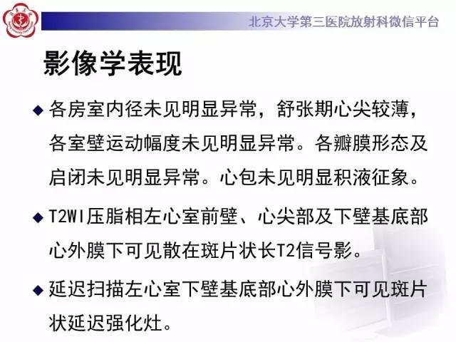【病例】急性心肌炎1例CMR表现