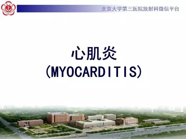 【病例】急性心肌炎1例CMR表现