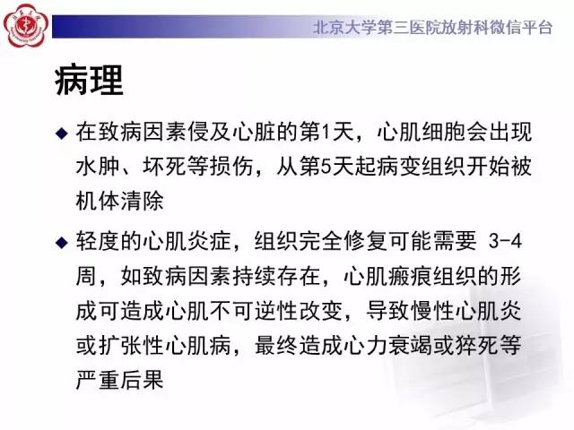 【病例】急性心肌炎1例CMR表现