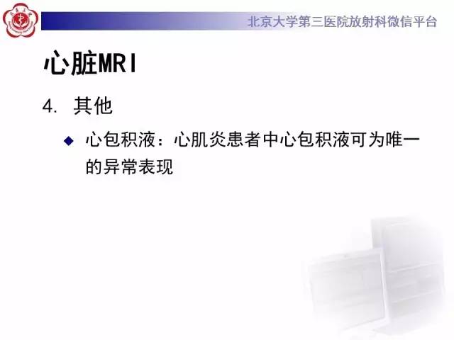 【病例】急性心肌炎1例CMR表现