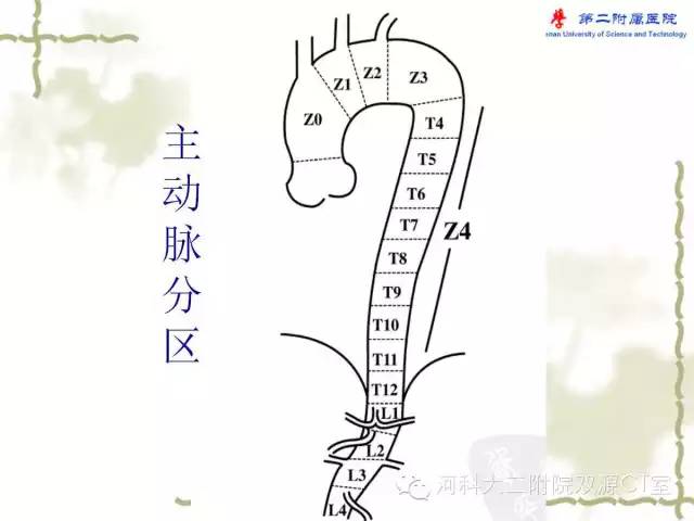 【PPT】循环系统影像学之——主动脉疾病