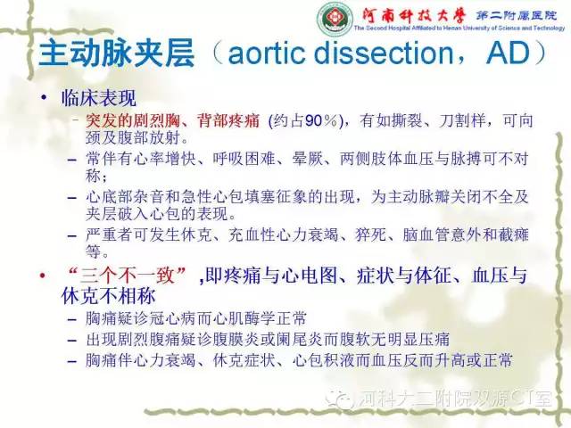 【PPT】循环系统影像学之——主动脉疾病