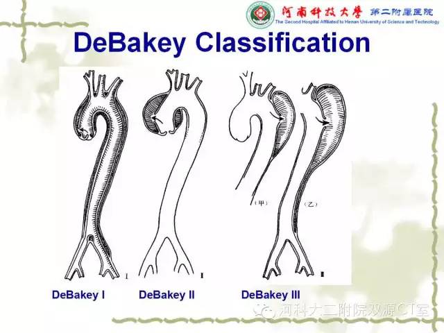 【PPT】循环系统影像学之——主动脉疾病