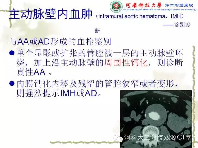 【PPT】循环系统影像学之——主动脉疾病