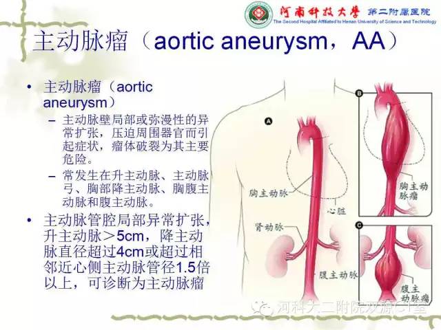 【PPT】循环系统影像学之——主动脉疾病