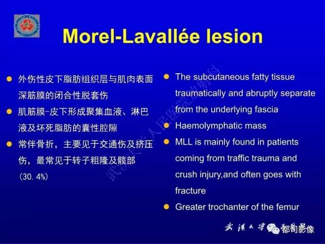 【PPT】含液-液平面软组织病变影像诊断