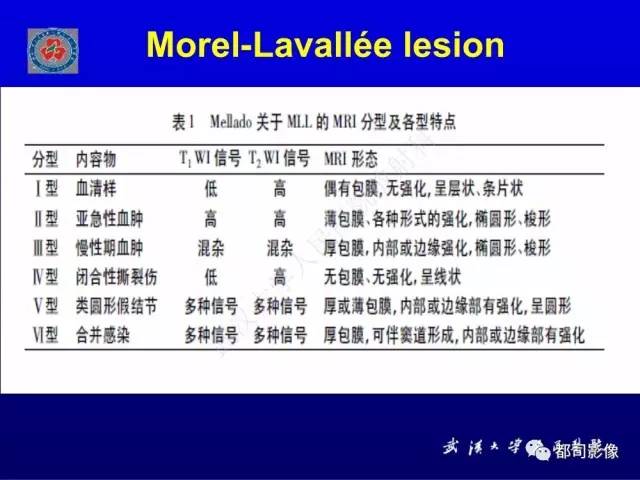 【PPT】含液-液平面软组织病变影像诊断