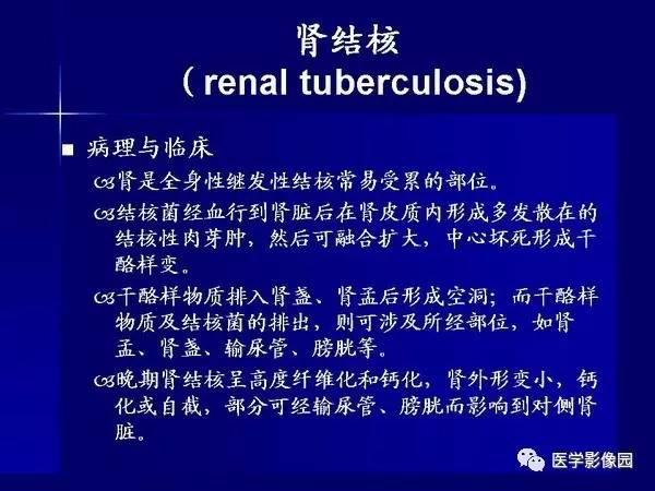 【PPT】肾脏常见病变的CT诊断