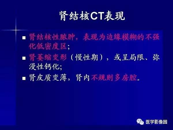 【PPT】肾脏常见病变的CT诊断